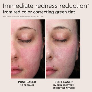 Foto 4 | Protector Solar Eltamd Uv Skin Recovery Spf 50 Para Pieles Sensibles - Venta Internacional.