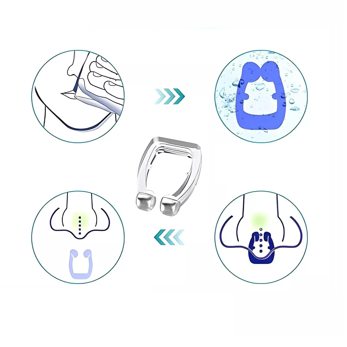 Foto 3 pulgar | Kit 6 Anti Ronquido Tapon Nasal Silicona  Eo Safe Imports  Esi-17550  Transparente