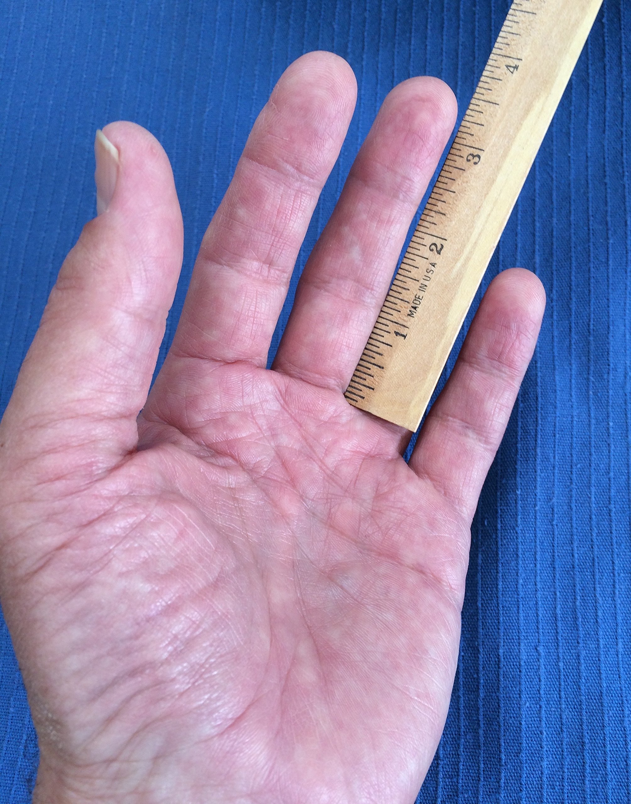 Foto 8 pulgar | Guante De Práctica Para Músicos Con Problemas Para Dedos Y Manos  Color Beige  Tamaño Mediano - Venta Internacional.
