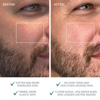 Foto 5 | Cepillo Limpiador Facial Foreo Luna 4 Men Masajeador Reafirmante - Venta Internacional.