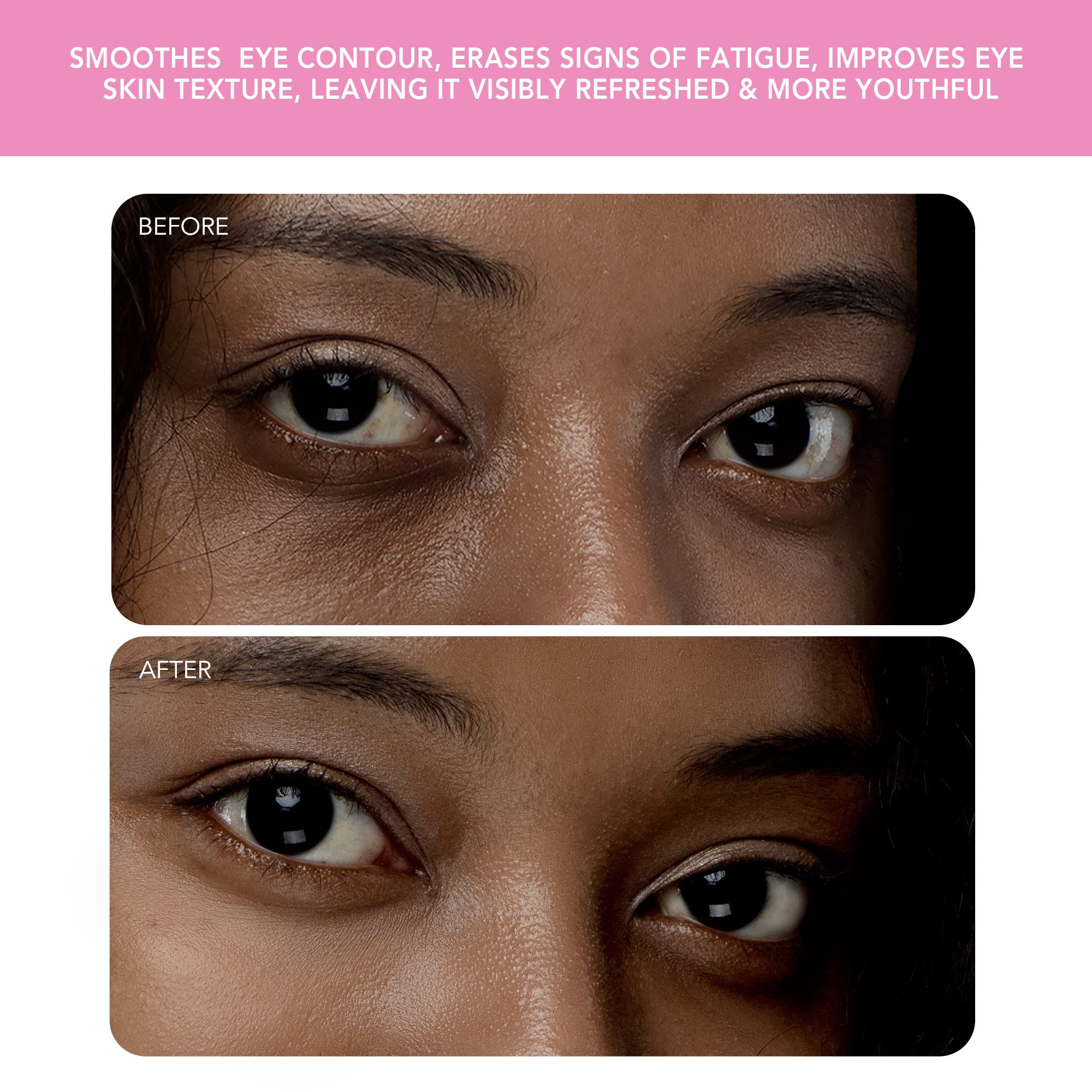Foto 8 pulgar | Masajeador De Ojos Foreo Iris 2 Linfatic Drenage Pearl Pink - Venta Internacional.