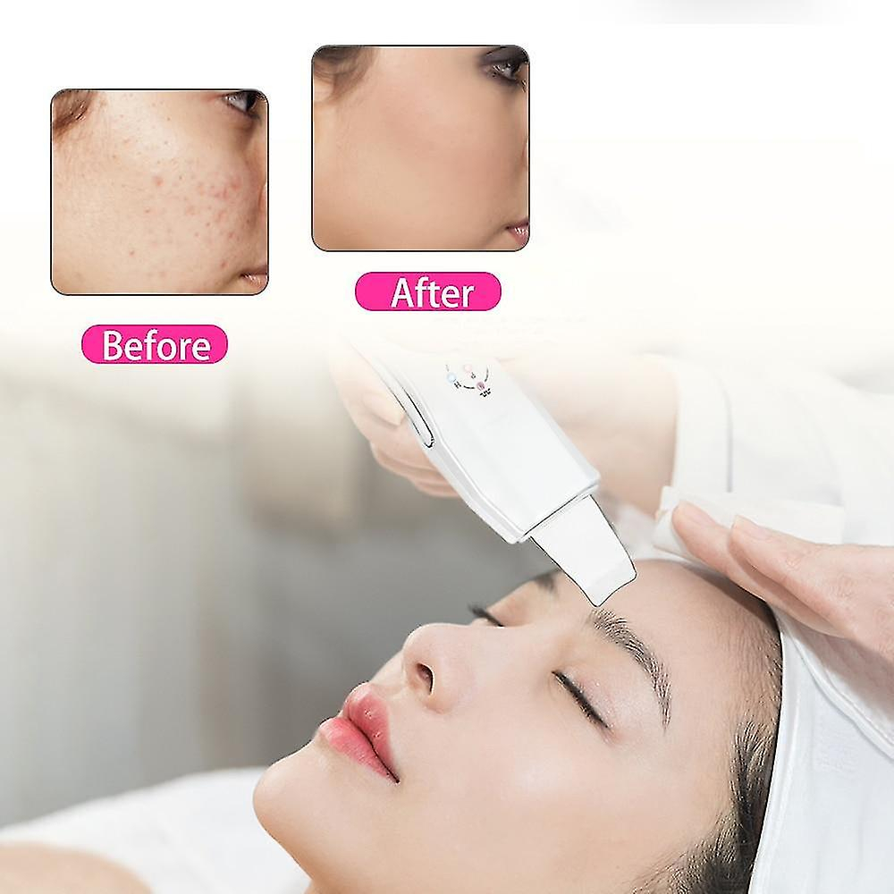 Foto 6 pulgar | Limpiador Facial  Depurador Ultrasónico De Piel  Masajeador Huoguo - Venta Internacional.