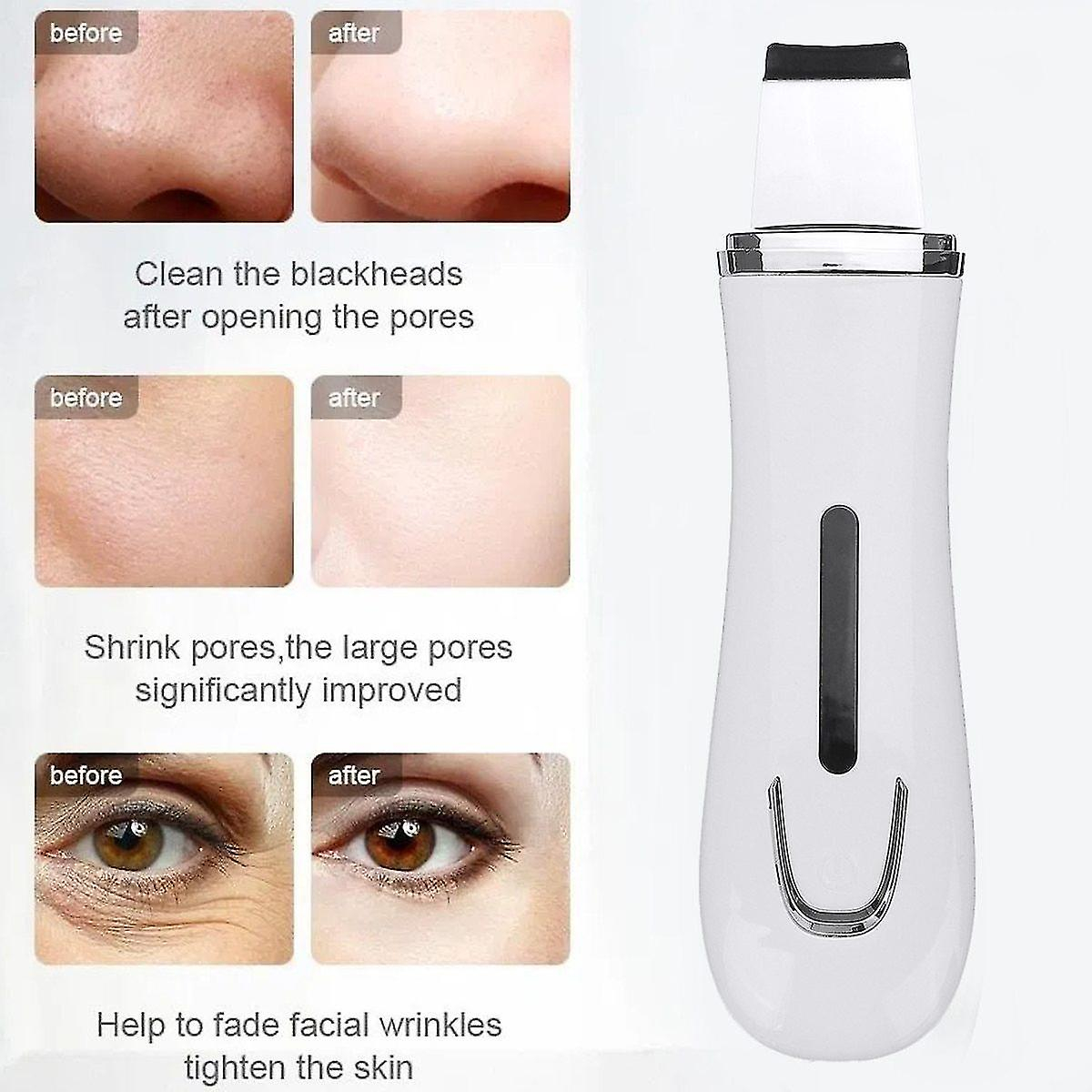 Foto 4 pulgar | Kit De Cuidado De La Piel Antienvejecimiento  Depurador De Piel Ultrasónico Huoguo - Venta Internacional.