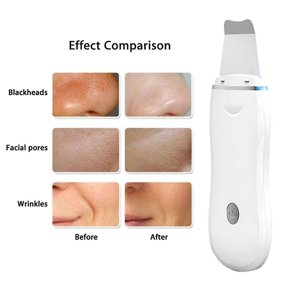 Foto 5 pulgar | Limpiador Facial Huoguo Depurador Ultrasónico De Piel Blanco - Venta Internacional.