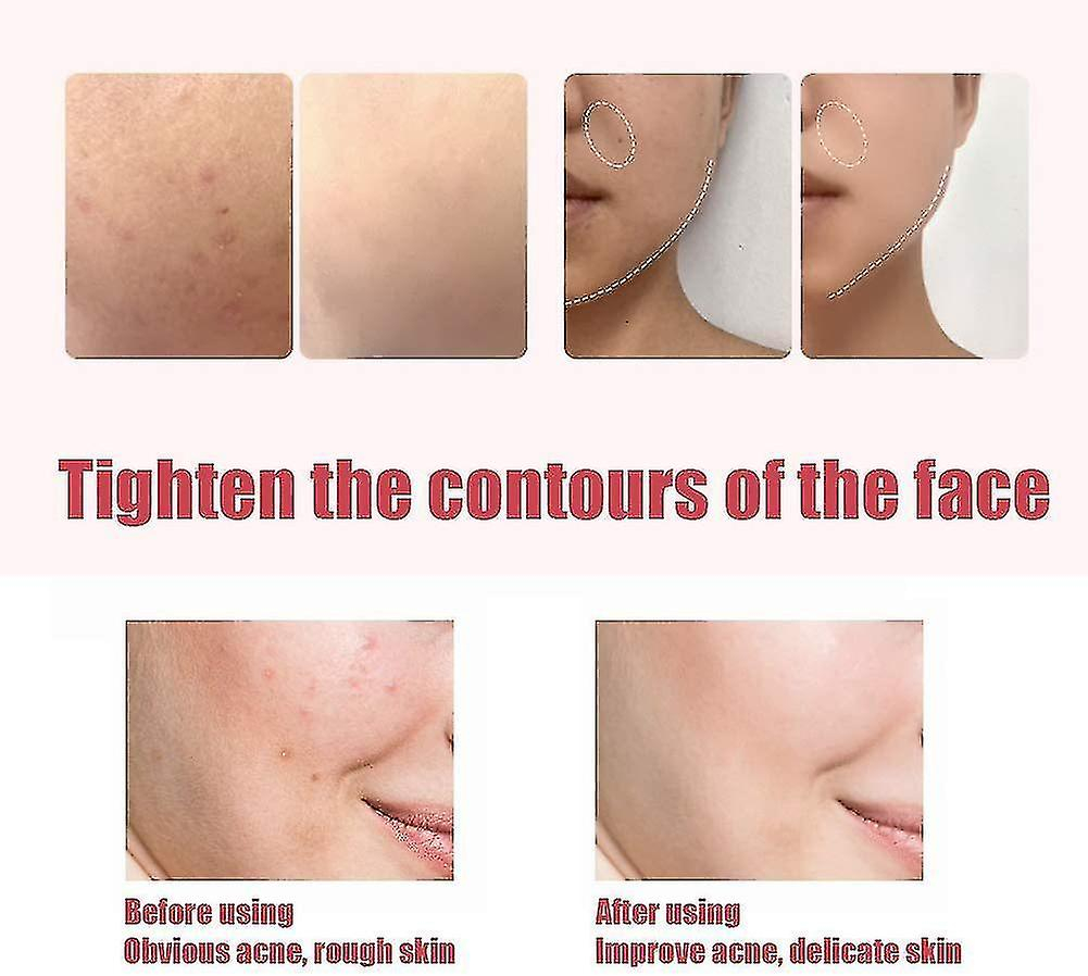 Foto 6 pulgar | Limpiador Facial  Dispositivo De Belleza  Limpieza Ultrasónica De Poros  Rosa - Venta Internacional.