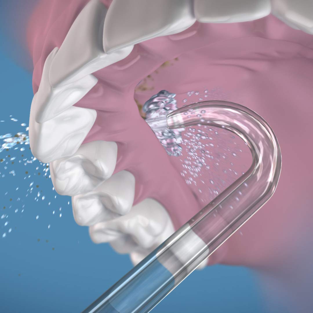 Foto 5 pulgar | Repuesto De Punta De Hilo Dental Waterpik Dt-100e, 2 Unidades - Venta Internacional.