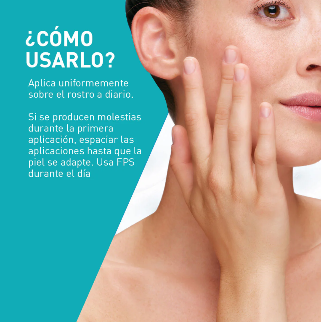 Foto 5 pulgar | Cerave Sérum Anti-imperfecciones Retinol y Niacinamida Antiacné Barros y Espinillas 30 ml