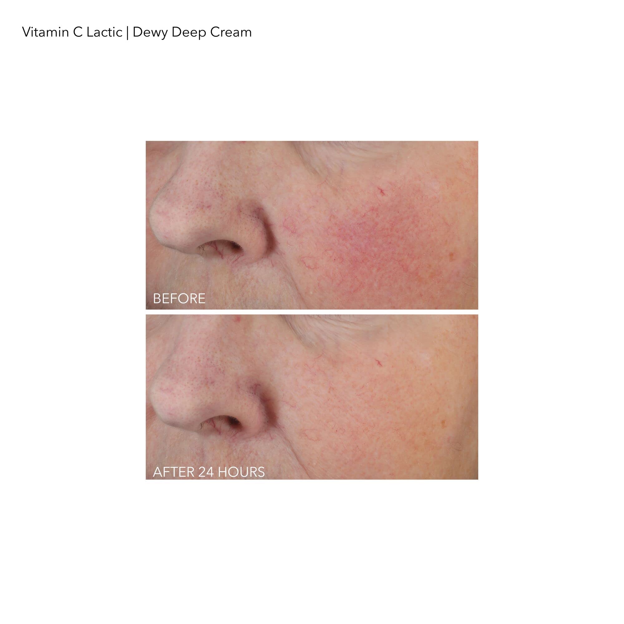 Foto 7 | Crema Dr. Dennis Gross Con Vitamina C, Láctica Y Profunda, 60 Ml - Venta Internacional.