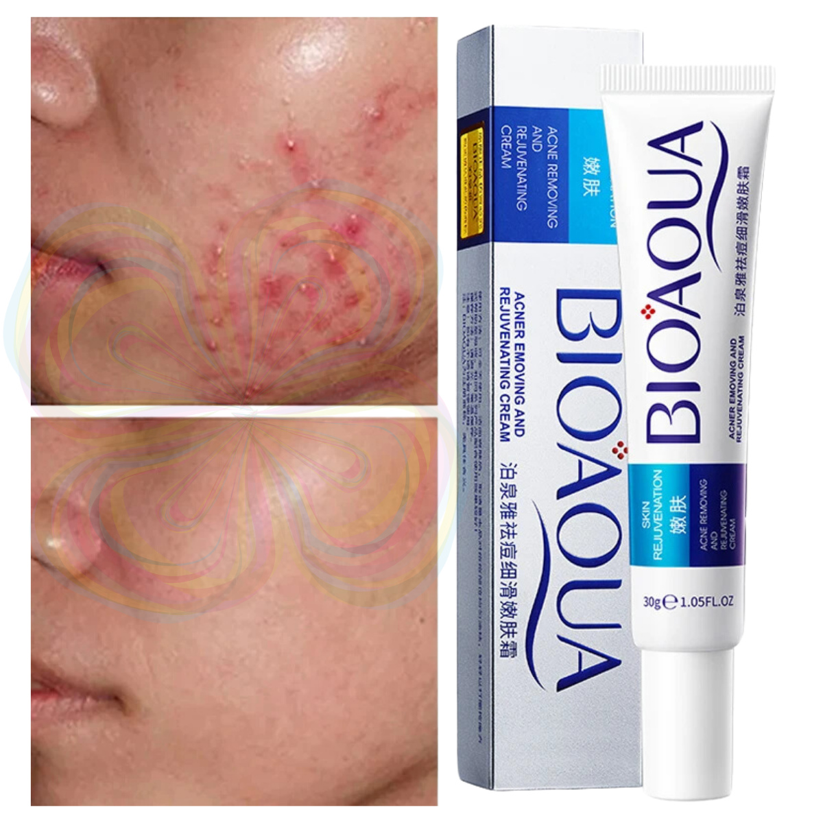 Foto 2 pulgar | Crema Bioaqua Puntos Negros Anti Acne Cicatrices Poros