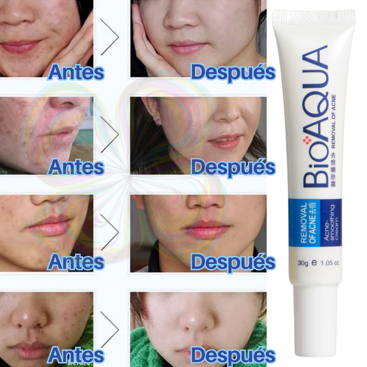 Foto 3 pulgar | Crema Bioaqua Puntos Negros Anti Acne Cicatrices Poros