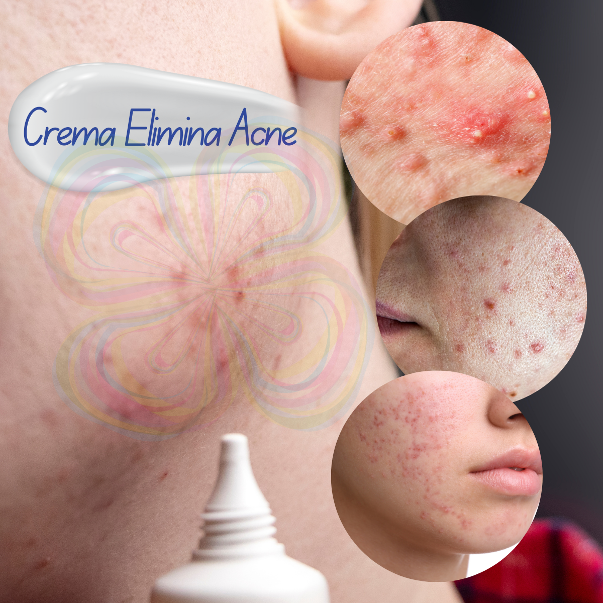 Foto 8 pulgar | Crema Bioaqua Puntos Negros Anti Acne Cicatrices Poros