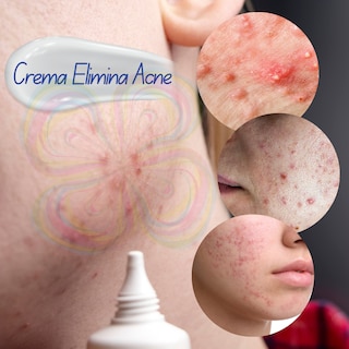 Foto 7 | Crema Bioaqua Puntos Negros Anti Acne Cicatrices Poros