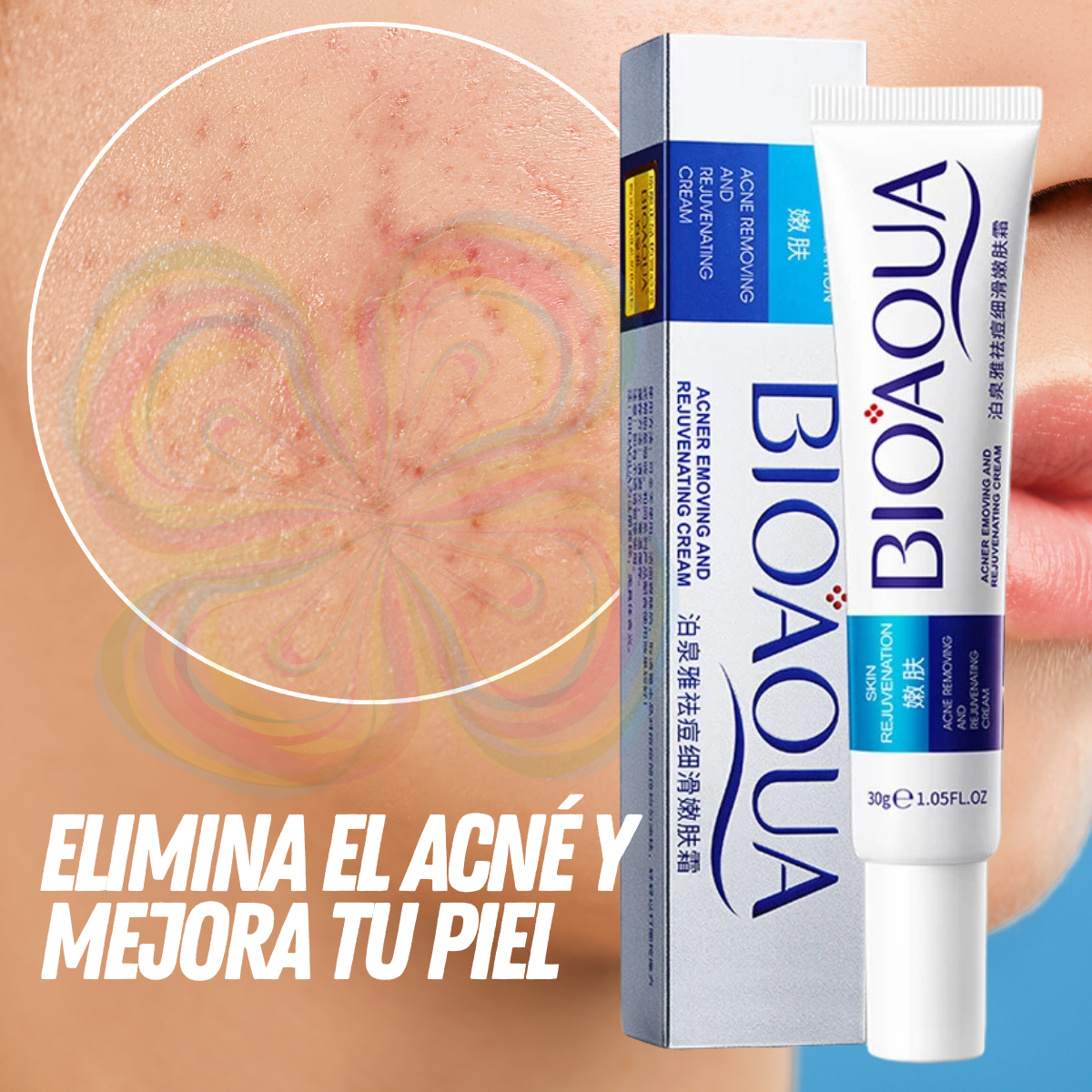 Foto 9 pulgar | Crema Bioaqua Puntos Negros Anti Acne Cicatrices Poros