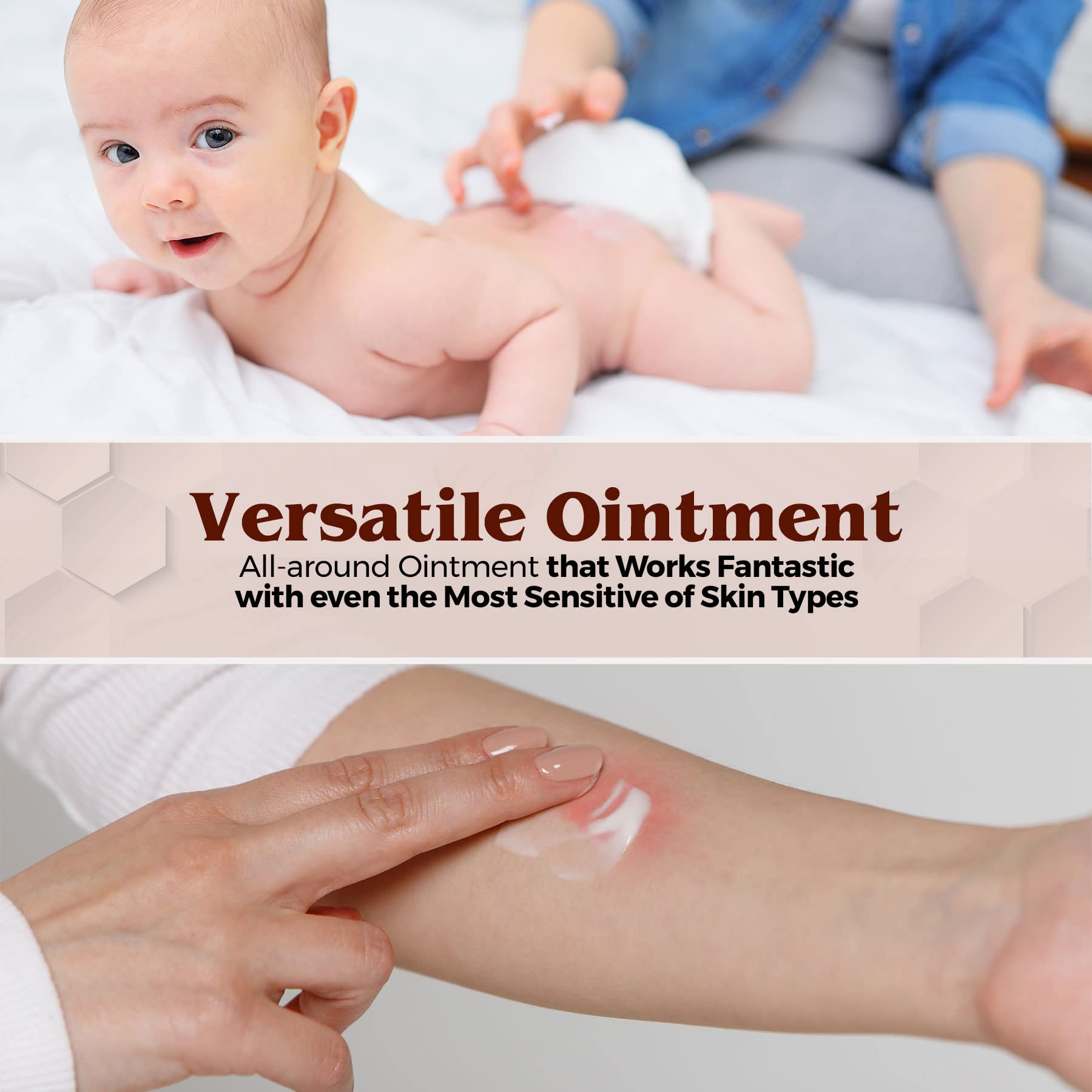 Foto 7 pulgar | Pomada Para Dermatitis Del Pañal Medca, Vitamina A Y D, 30 Ml, Paquete De 6 - Venta Internacional.