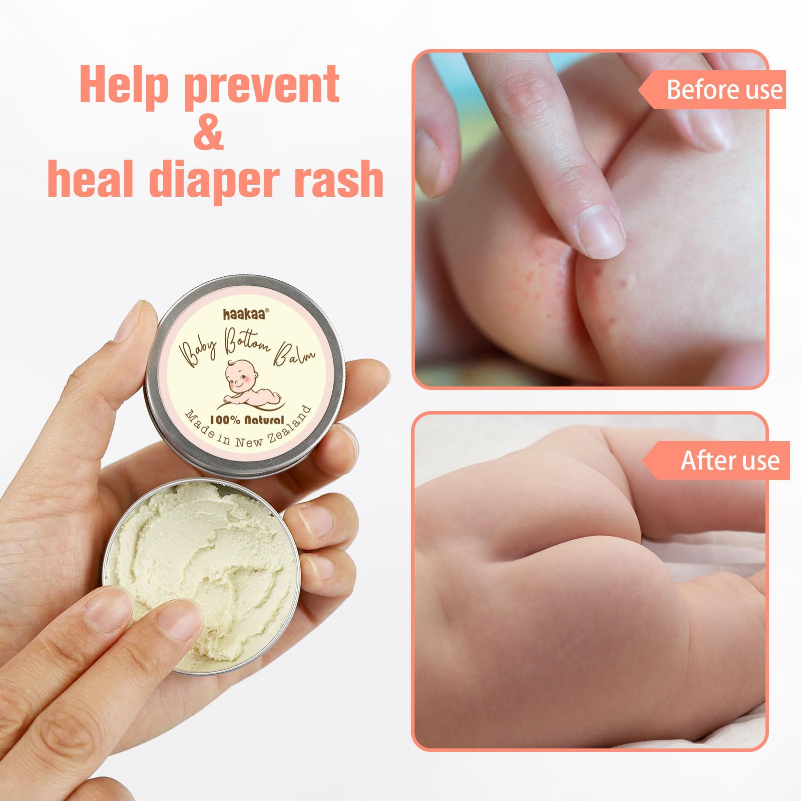 Foto 6 pulgar | Crema Para Dermatitis Del Pañal Haakaa Baby Prevents, Calma La Piel Seca, 50 Ml - Venta Internacional.