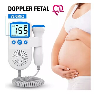 Foto 2 | Monitor Fetal Doppler Ultrasonido Genérica Bebé Latidos Corazón Eo Safe Imports Esi-17366 Multicolor