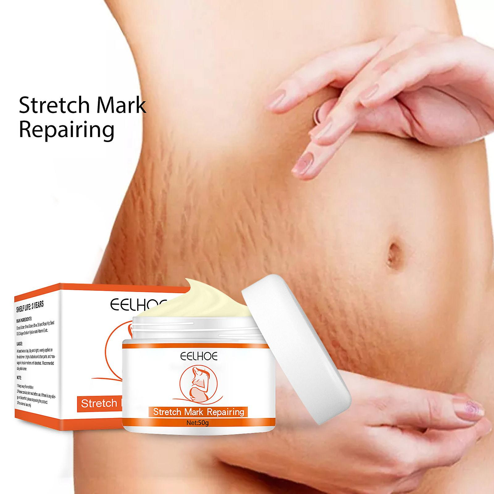 Foto 2 | Loción Corporal Y Crema De Masaje Para Estrías Huoguo Que Atenúa Las Líneas Finas - Venta Internacional.