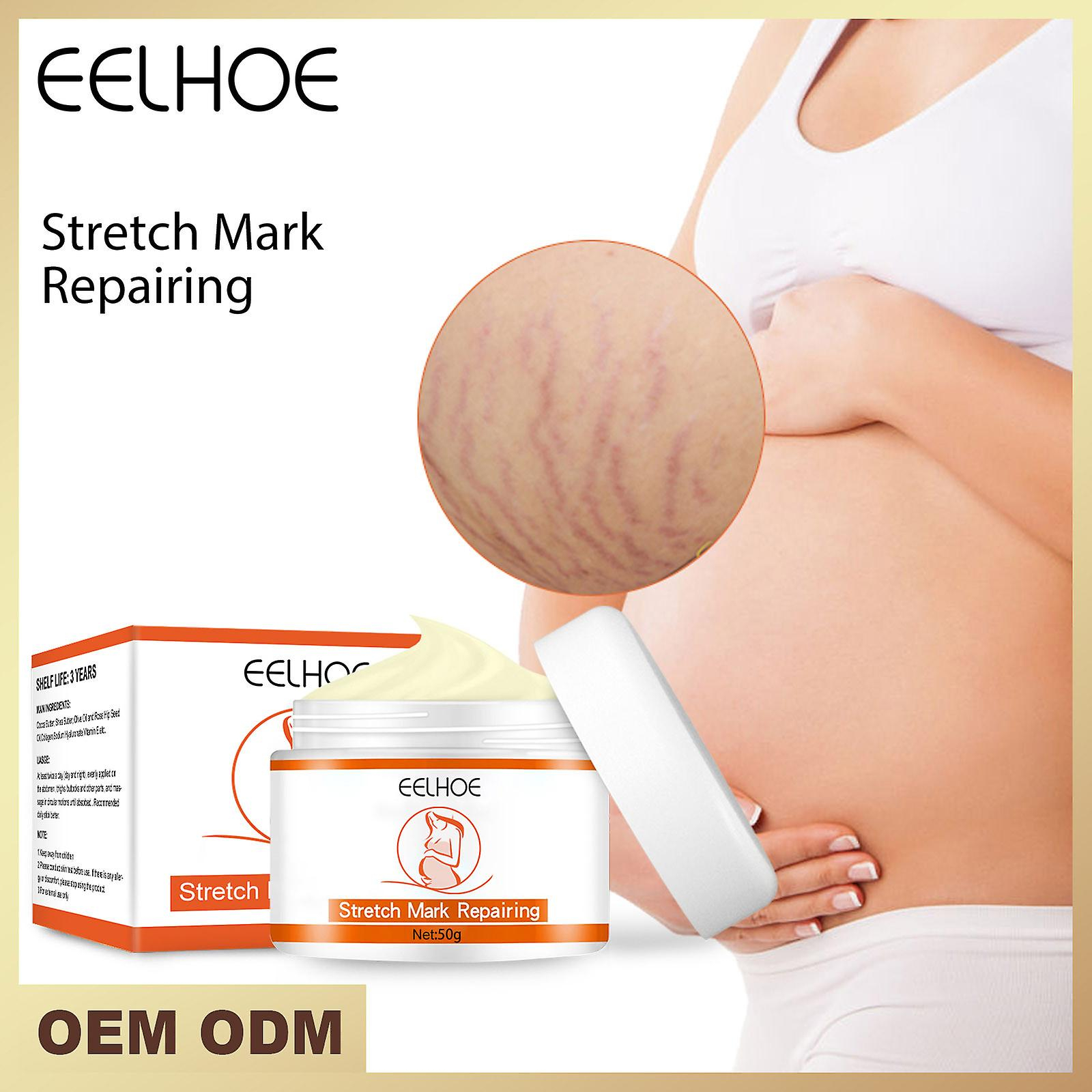 Foto 4 pulgar | Loción Corporal Y Crema De Masaje Para Estrías Huoguo Que Atenúa Las Líneas Finas - Venta Internacional.