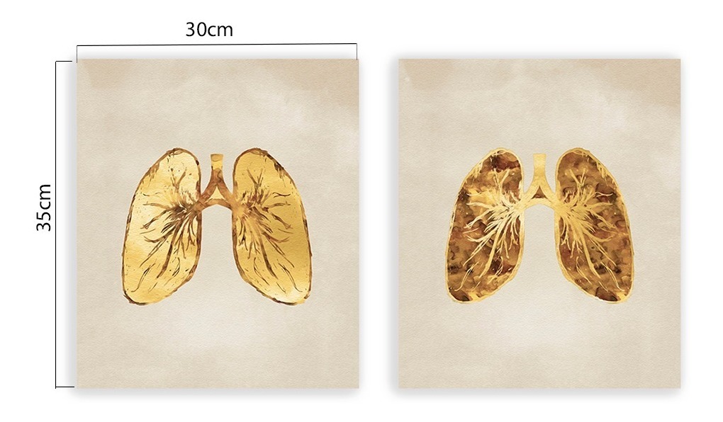 Foto 4 | Set Cuadros Decorativos Canvas Consultorio Medico Pulmones