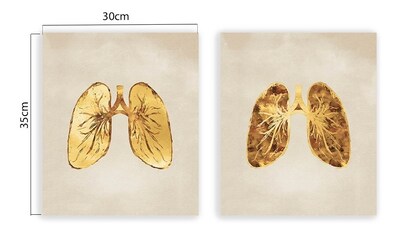 Foto 4 | Set Cuadros Decorativos Canvas Consultorio Medico Pulmones