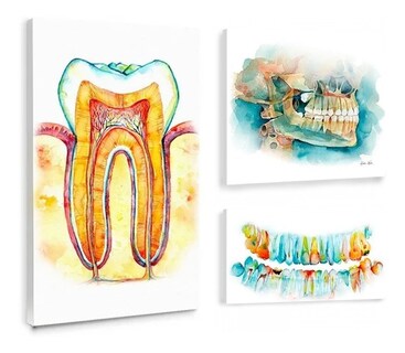 Foto 1 | Cuadros Dentista Odontología Dientes Set En Canvas Con Marco
