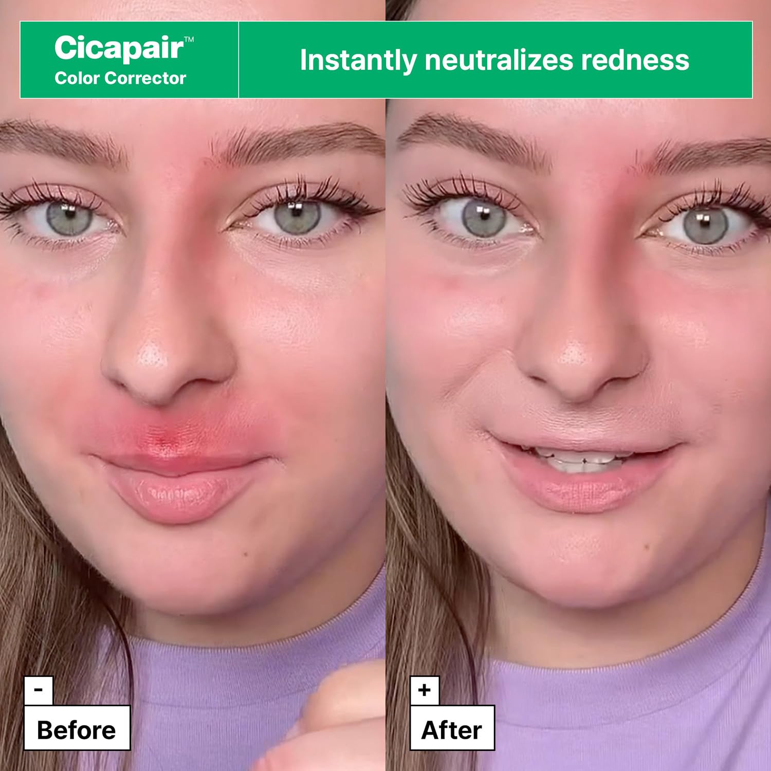 Foto 4 | Set De Cuidado De La Piel Dr.jart+ Cicapair Redness Rescue Travel Size - Venta Internacional.