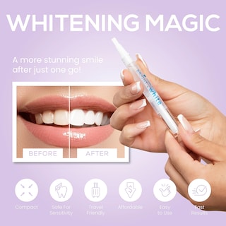 Foto 4 | Bolígrafo Blanqueador De Dientes Ganador Del Premio Venus Visage (2 Bolígrafos) - Venta Internacional.