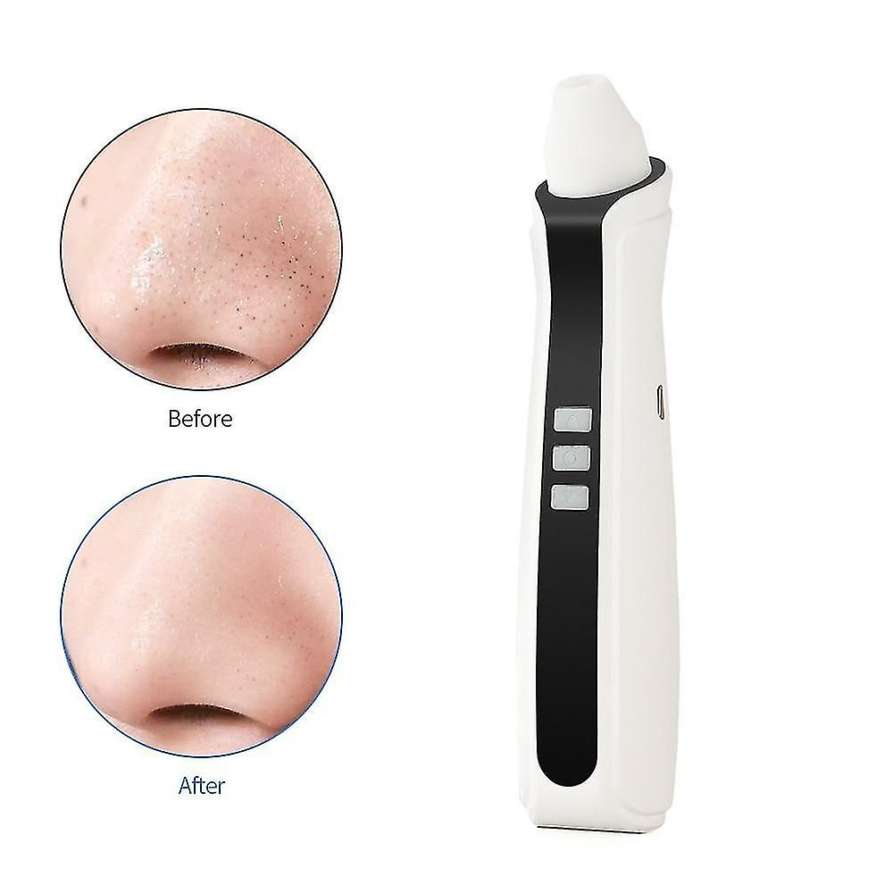 Limpiador Facial Removedor De Puntos Negros Huoguo Recargable Usb - Venta Internacional.