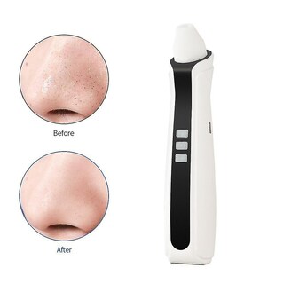 Foto 1 | Limpiador Facial Removedor De Puntos Negros Huoguo Recargable Usb - Venta Internacional.