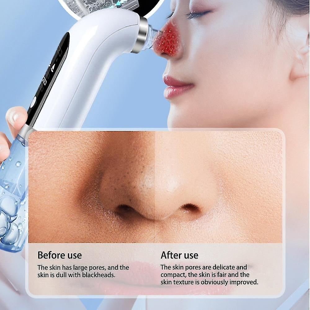 Foto 3 | Limpiador Facial  Eliminador De Puntos Negros  Acné Y Poros  Huoguo - Venta Internacional.