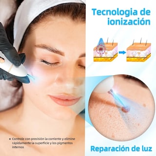 Foto 3 | Pluma Cauterizador Portátil Recargable Eo Safe Imports Esi-19022 Blanco