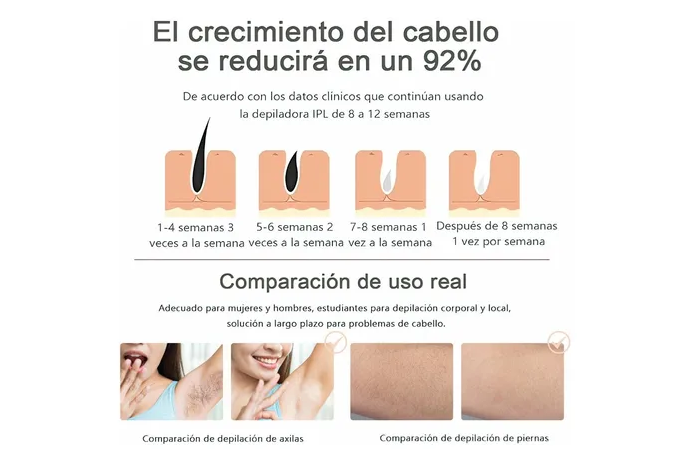 Foto 6 pulgar | Xtellar Depiladora Láser De Luz Pulsada Ipl – Transforma Tu Rutina De Belleza Con Depilación Indolora Y Permanente.