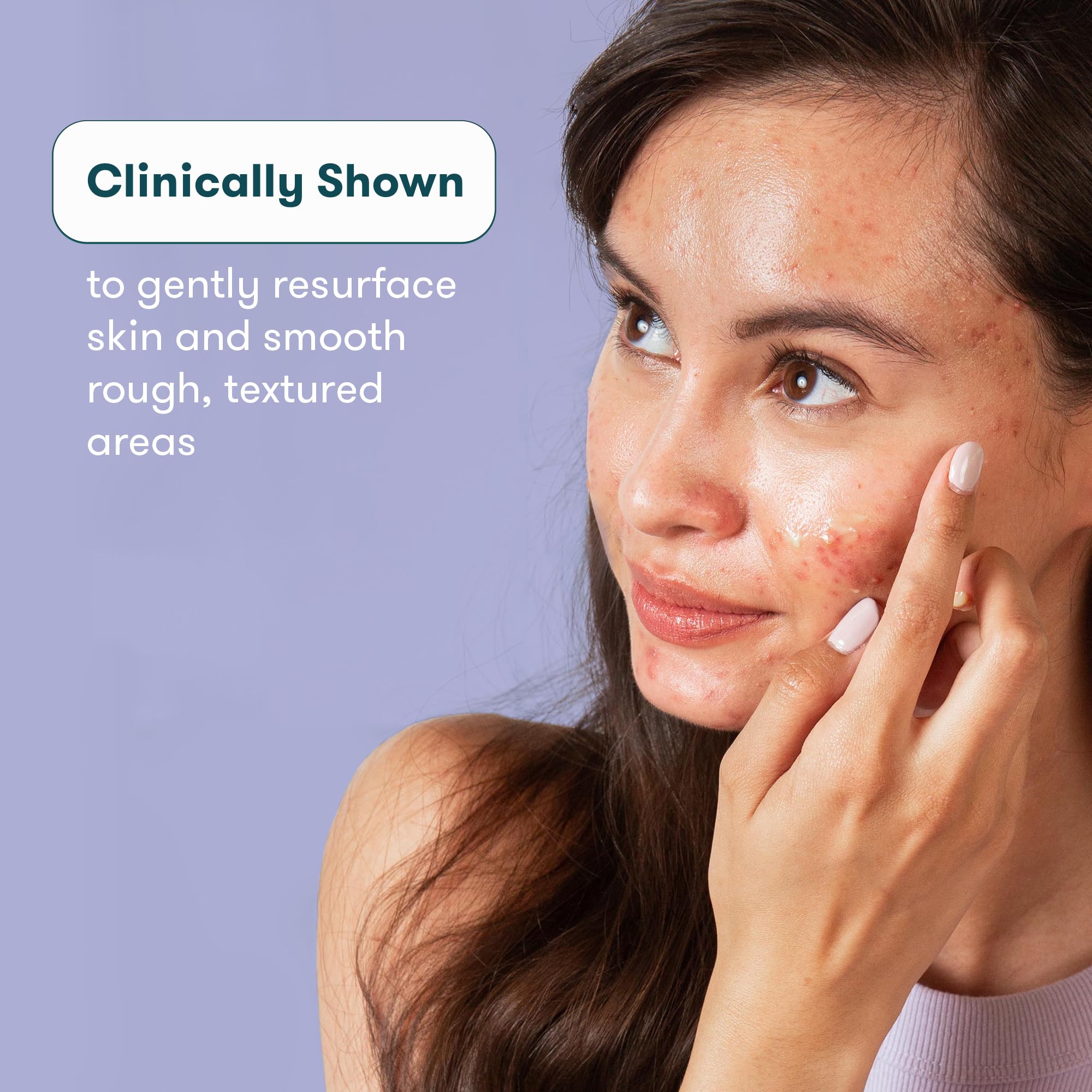 Foto 3 pulgar | Gel Facial Para Tratamiento De Cicatrices De Acné Proactiv - Venta Internacional.