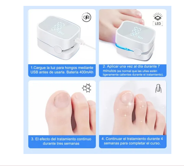 Foto 4 pulgar | Tratamiento Láser De Hongos En Las Uñas Y Onicomicosis