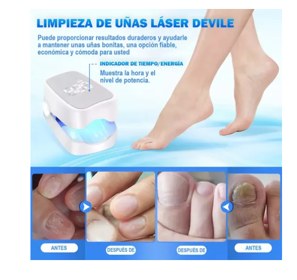 Foto 5 pulgar | Tratamiento Láser De Hongos En Las Uñas Y Onicomicosis