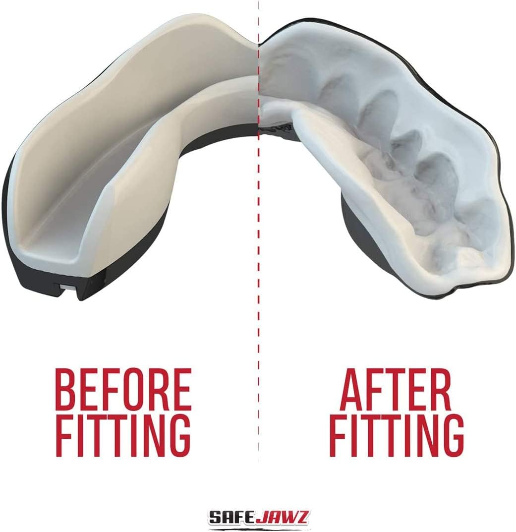 Foto 3 pulgar | Protector Bucal Safejawz Slim Fit Extro Series para Adultos Y Niños - Venta Internacional
