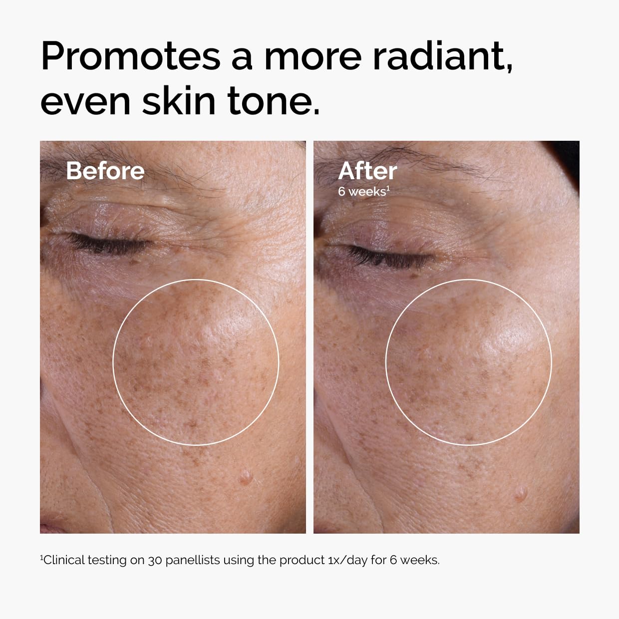 Foto 2 | Tonificador Exfoliante The Ordinary Ácido Glicólico 7% 100 ml - Venta Internacional