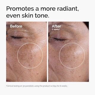 Foto 2 | Tonificador Exfoliante The Ordinary Ácido Glicólico 7% 100 ml - Venta Internacional