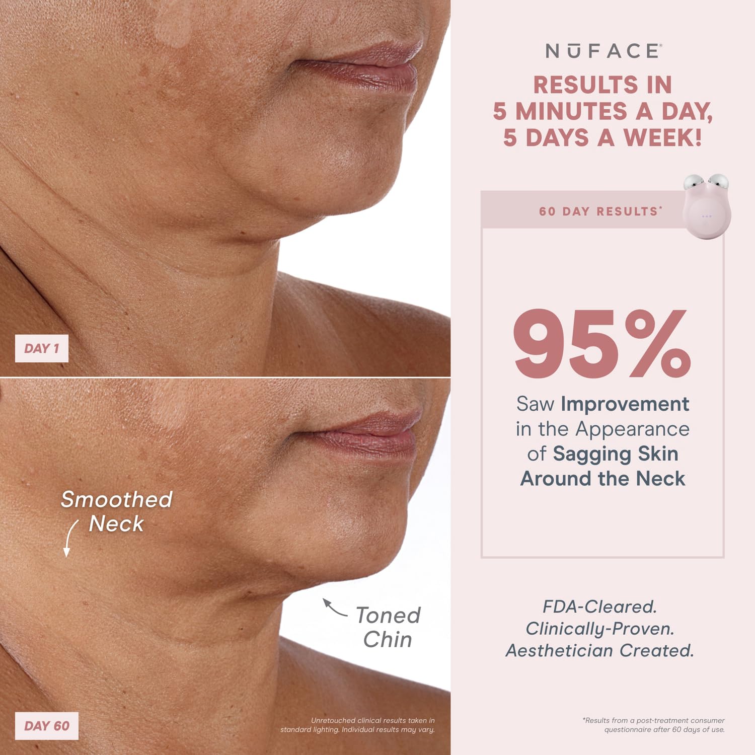 Foto 4 pulgar | Dispositivo Facial Nuface Mini+ Microcurrent Con Gel Y Crema De Seda - Venta Internacional.