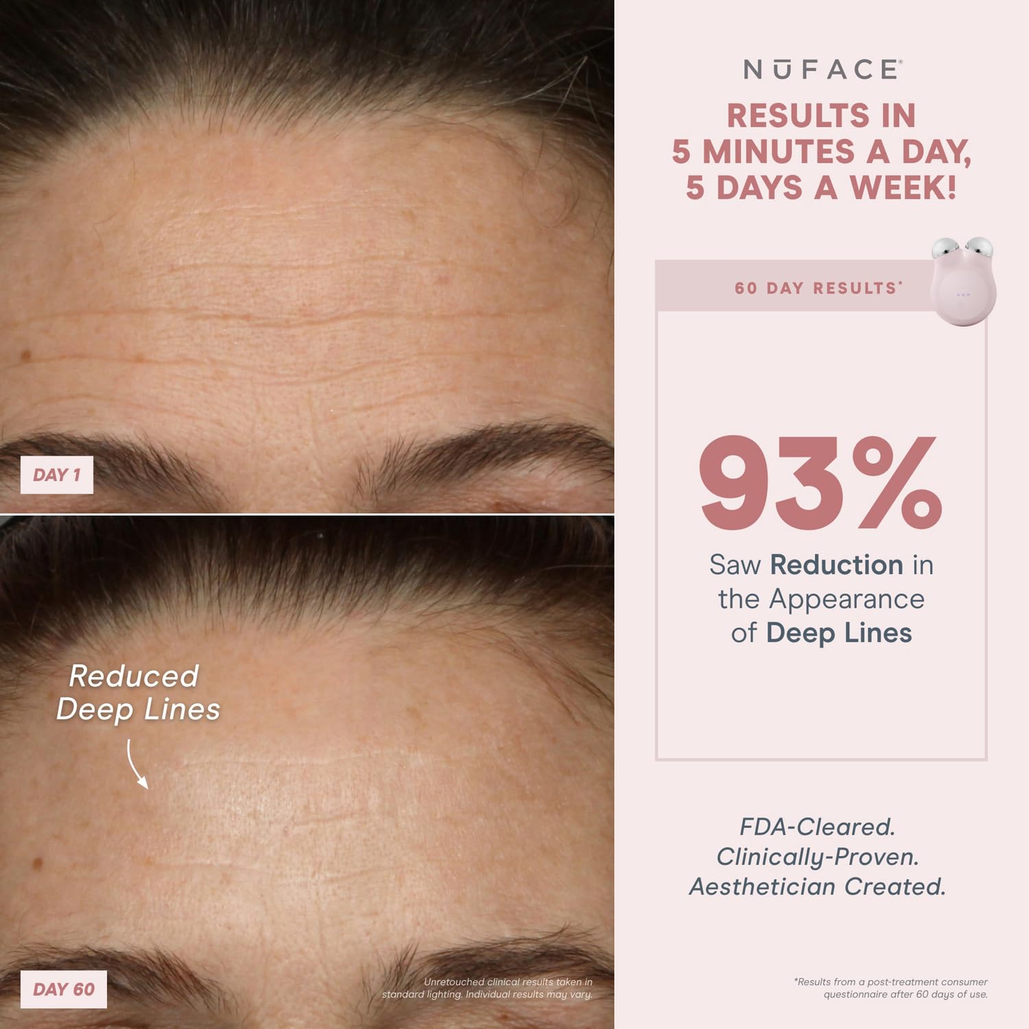 Foto 8 pulgar | Dispositivo Facial Nuface Mini+ Microcurrent Con Gel Y Crema De Seda - Venta Internacional.