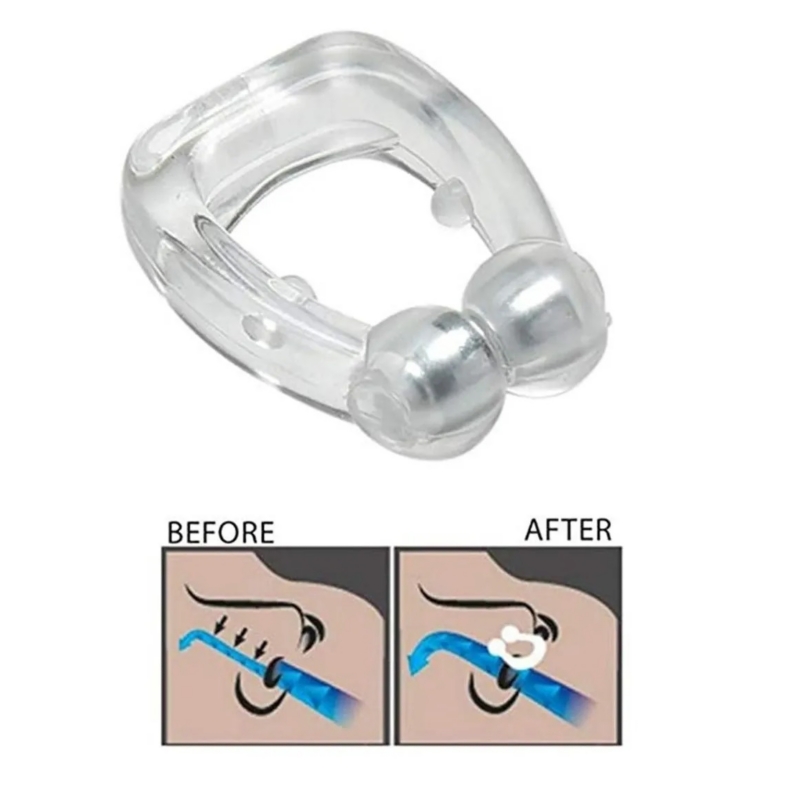 Foto 3 pulgar | Dispositivo Antirronquidos X5, Clip Antironquidos Con Imanes - Venta Internacional.