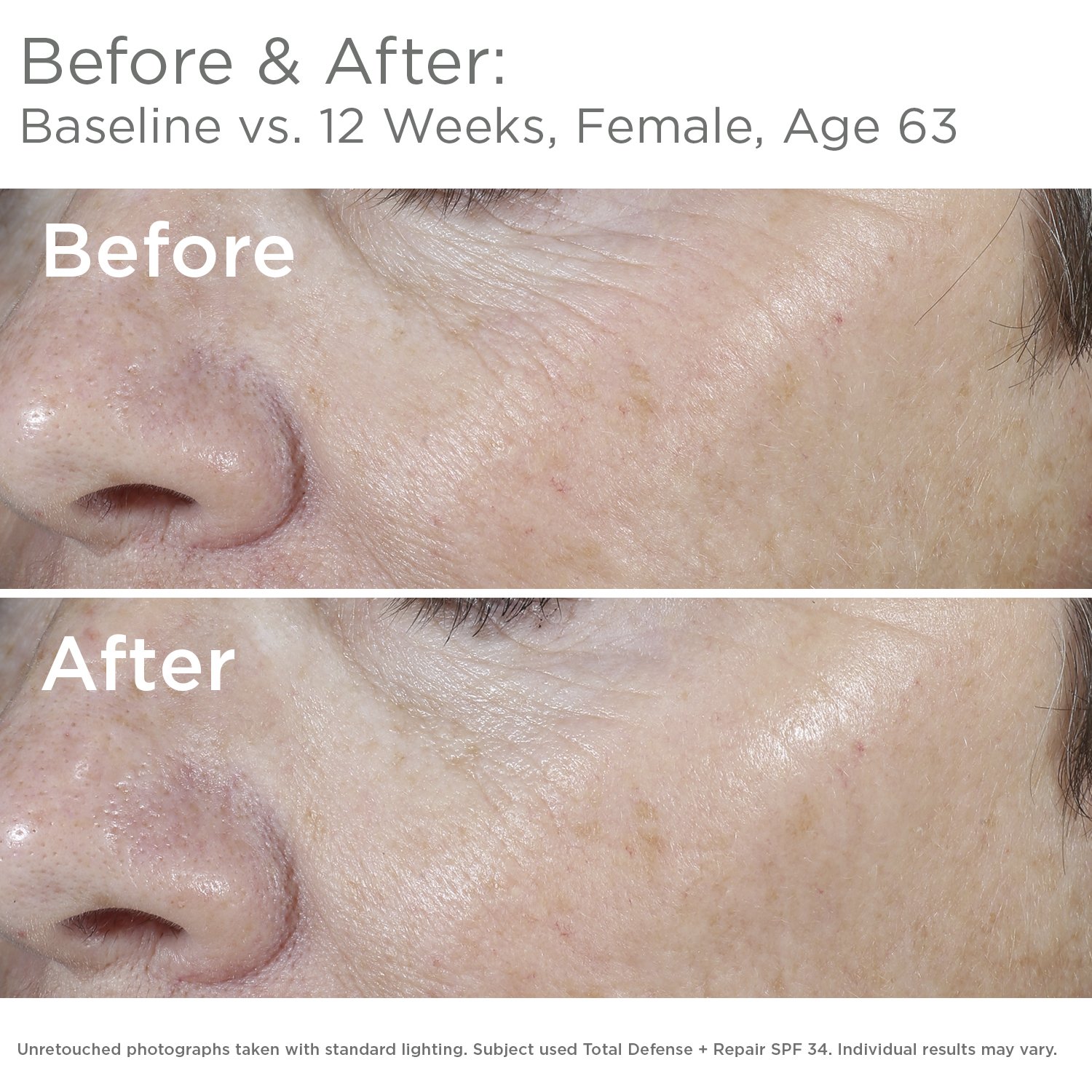 Foto 2 | Protector Solar Skinmedica Total Defense + Repair Spf 34 68 Ml - Venta Internacional.