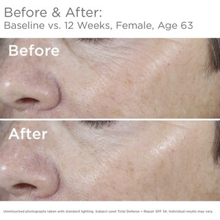 Foto 2 | Protector Solar Skinmedica Total Defense + Repair Spf 34 68 Ml - Venta Internacional.