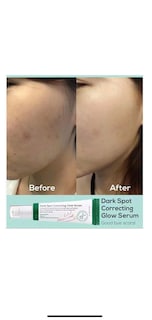 Foto 7 | Protector Solar Axis-y Complete No-stress Physical, Versión 3, 60 Ml - Venta Internacional.