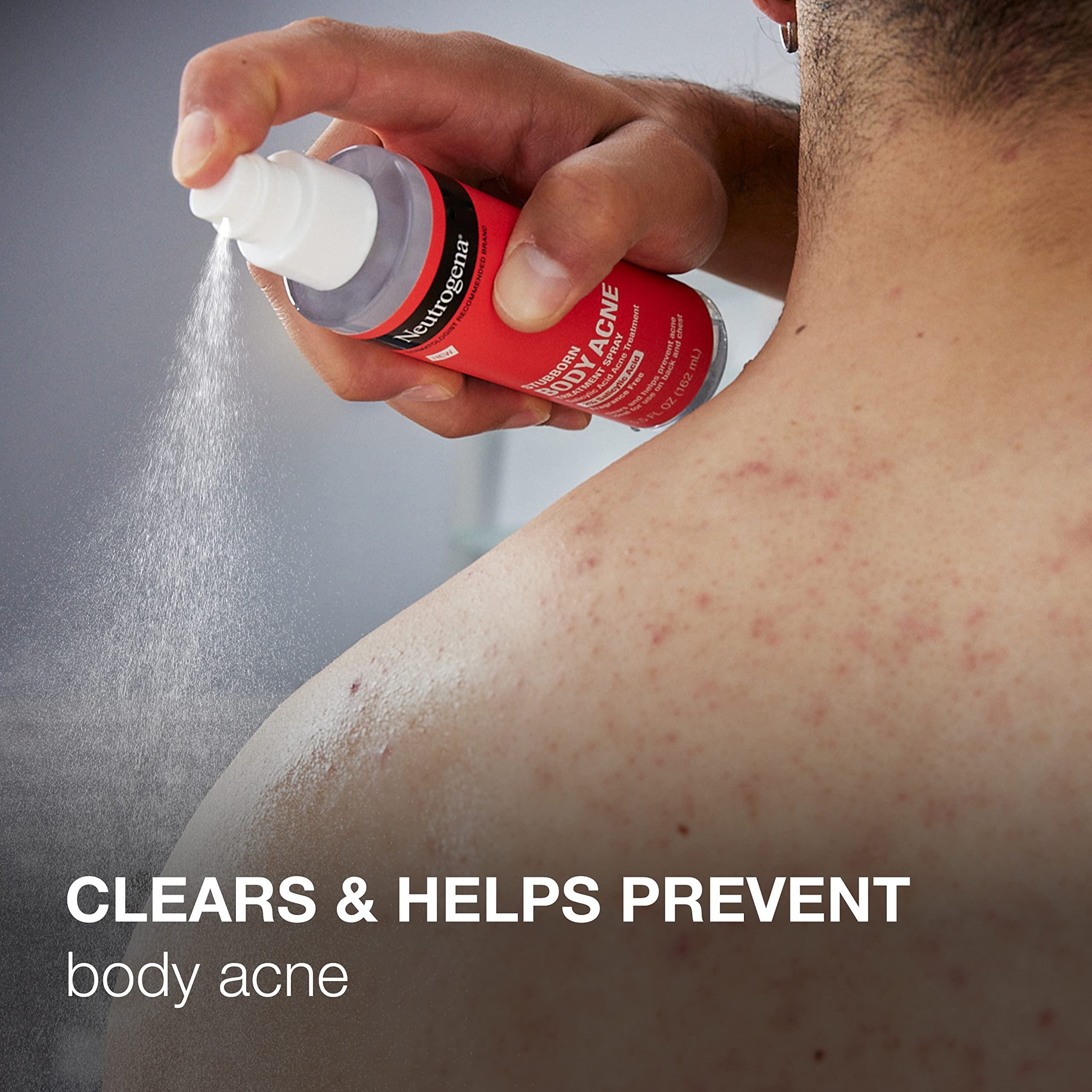 Foto 3 pulgar | Spray Acné Neutrogena Stubborn con Ácido Salicílico 162 Ml - Venta Internacional