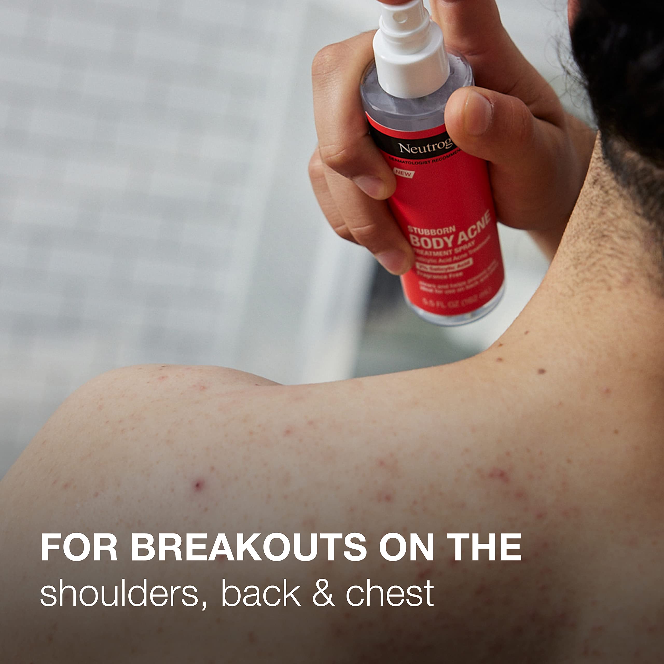 Foto 5 pulgar | Spray Acné Neutrogena Stubborn con Ácido Salicílico 162 Ml - Venta Internacional