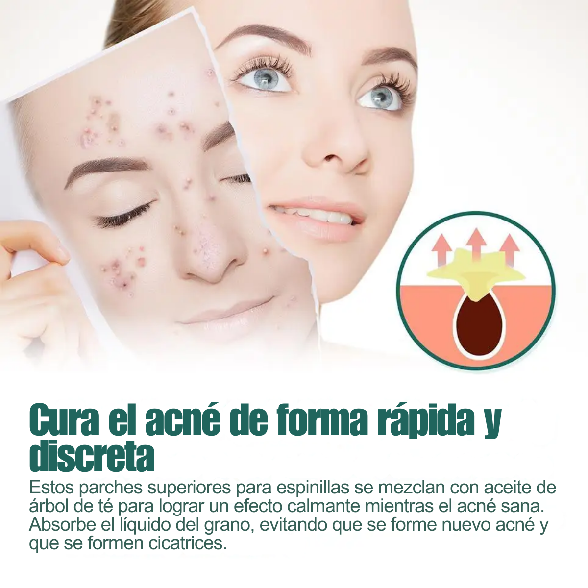 Foto 6 pulgar | 112 Star-parches Invisibles Eliminar Acne Estrella Granos