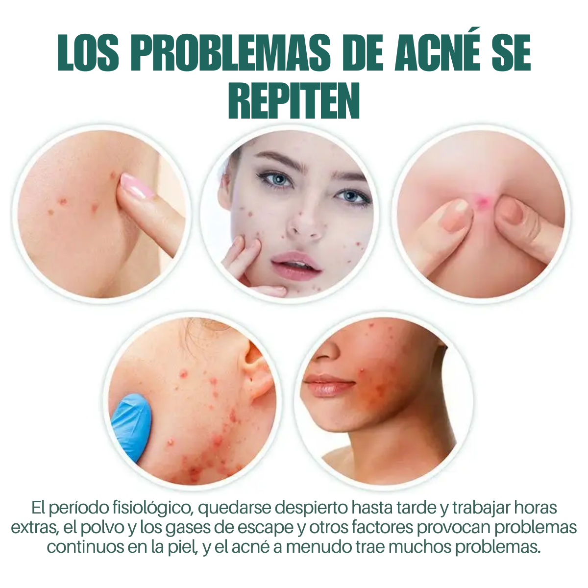 Foto 7 | 112 Star-parches Invisibles Eliminar Acne Estrella Granos