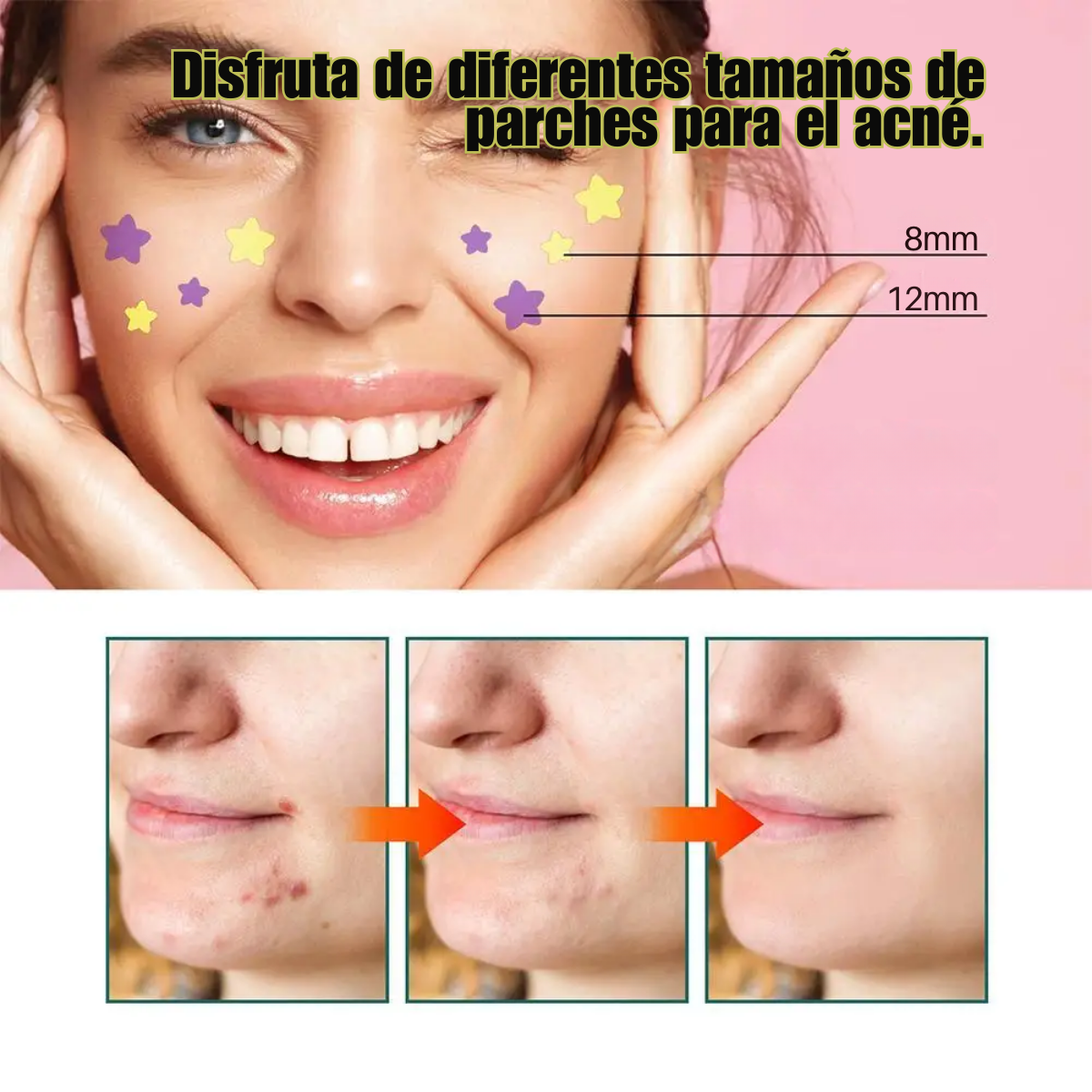 Foto 9 pulgar | 112 Star-parches Invisibles Eliminar Acne Estrella Granos