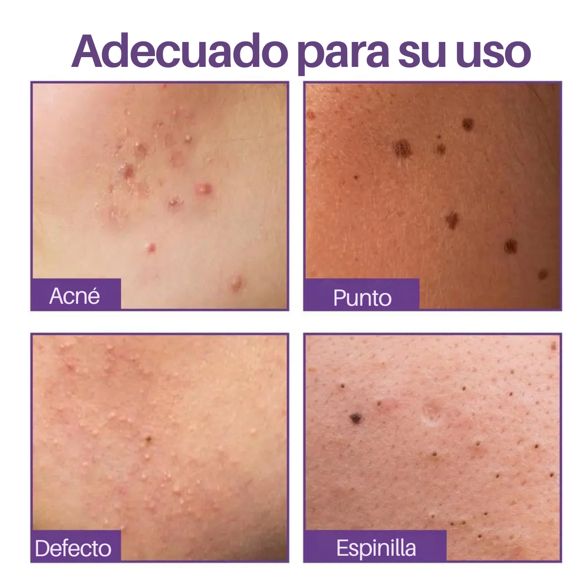 Foto 8 pulgar | Parches Cubre Acné Estrellas
